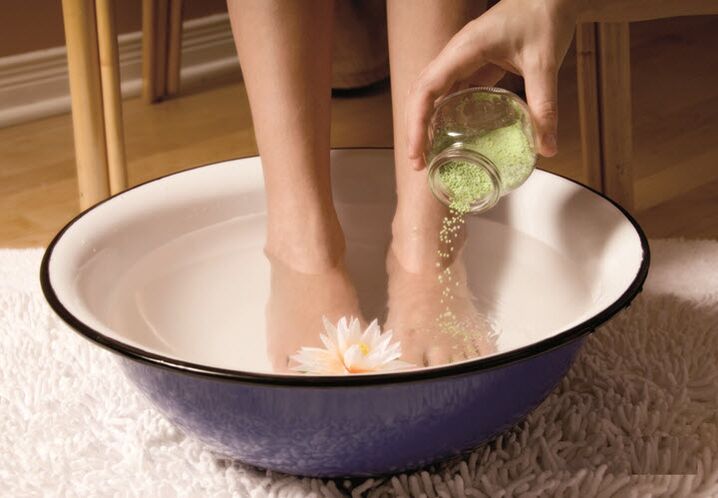 Treatment of varicose veins