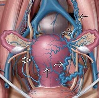 Changing the structure of the vascular walls